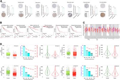 Identification of a lipid metabolism-related gene for cancer immunotherapy